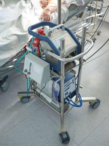 Extracorporeal membrane oxygenation. Working ECMO machine in intensive care department
