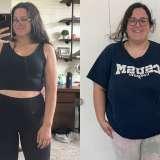 Joanna's Story - Before and After Roux-en-Y Gastric Bypass Surgery