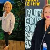 Sandra - Before and After Gastric Sleeve Surgery at UCLA